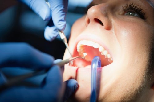 Fehlerhafte Zahnarztbehandlung – Patient muss Zahnarzt Nacherfüllung einräumen