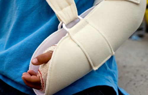 Unterfallversicherung: Invaliditätsentschädigung nach körperfernen Trümmerbruch von Elle und Speiche