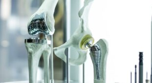 Fehlerhafte Implantation einer Kniegelenksprothese – Schmerzensgeld