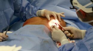Schmerzensgeldanspruch bei Anfertigung von Lichtbildern während einer Brustoperation