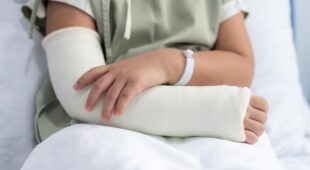 Verkehrsunfall – Schmerzensgeldhöhe bei Arm- und Handbrüchen
